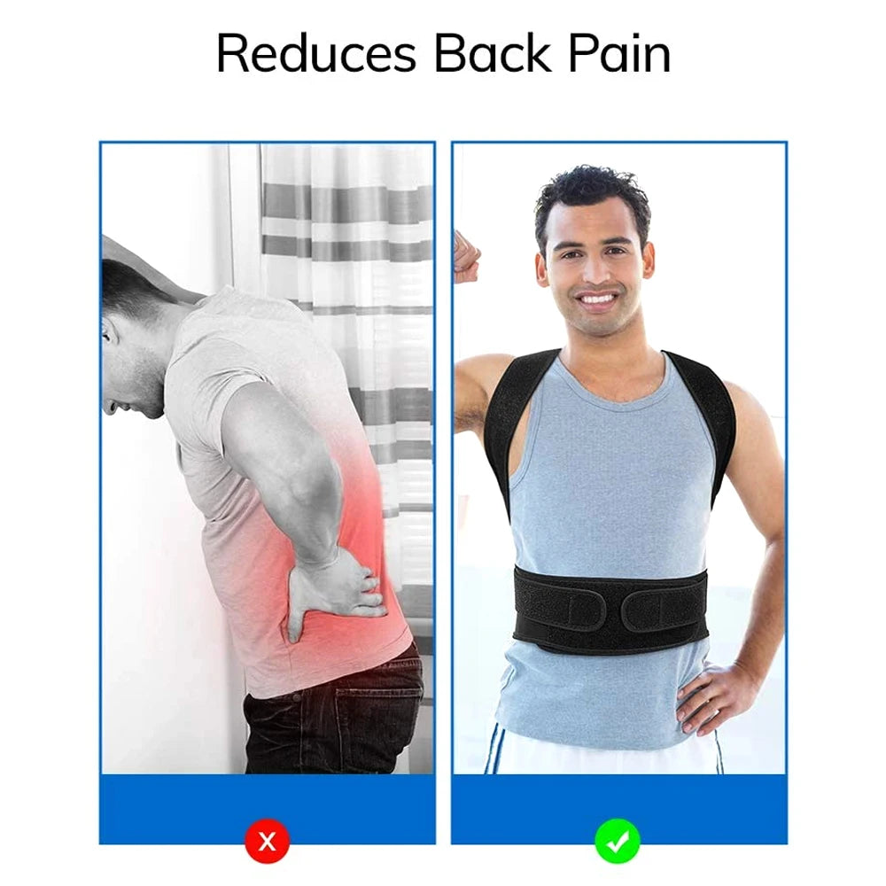 YoyoGym Posture Corrector – Back Support Brace for Improved Alignment