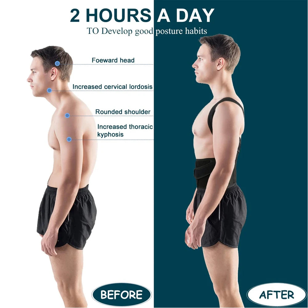 YoyoGym Posture Corrector – Back Support Brace for Improved Alignment